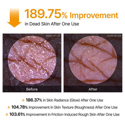 Bloombel™-Peel Shot Keratin Care