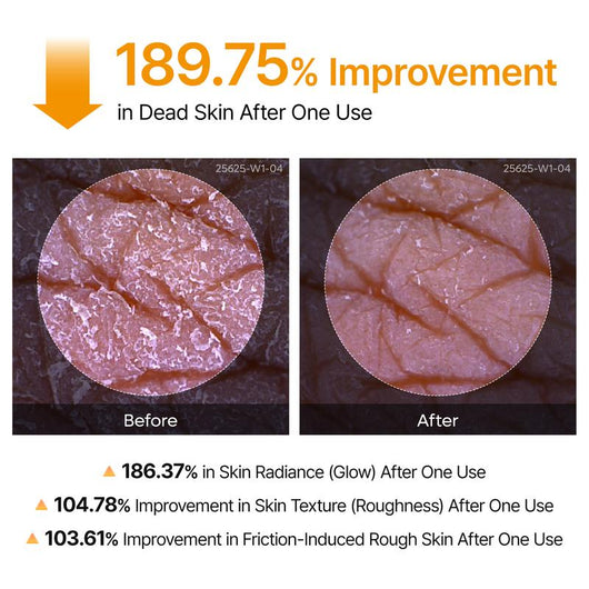 Bloombel™-Peel Shot Keratin Care